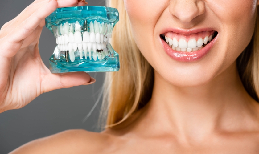 full mouth dental implants